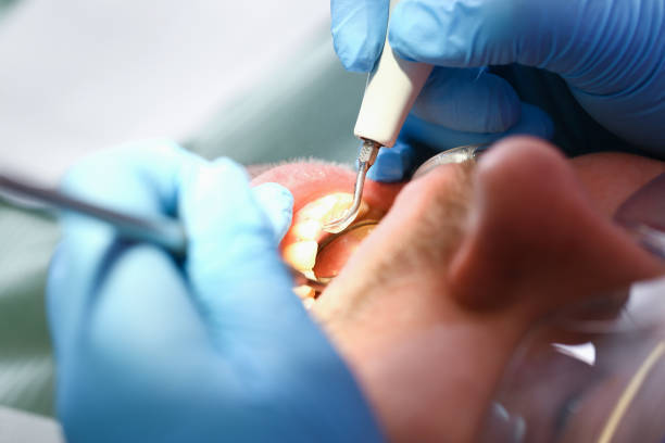 Best Walk-In Emergency Dental Services in Piketon, OH