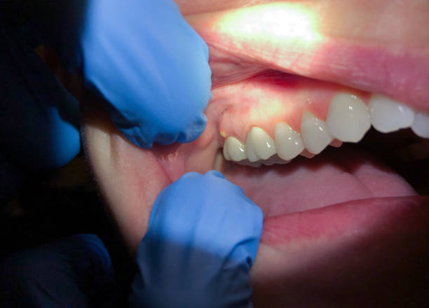Best Emergency Treatment for Jaw Pain or Injury in Piketon, OH